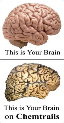 Brains